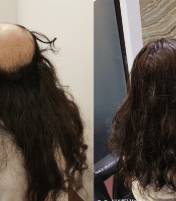 Profile picture of Hair Replacement SG